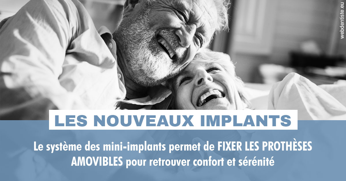 https://dr-picard-nicolas.chirurgiens-dentistes.fr/Les nouveaux implants 2