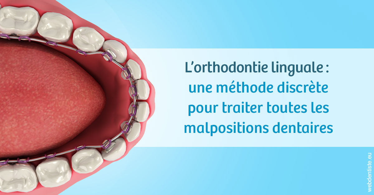 https://dr-picard-nicolas.chirurgiens-dentistes.fr/L'orthodontie linguale 1