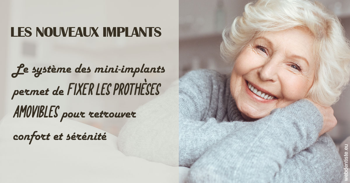 https://dr-picard-nicolas.chirurgiens-dentistes.fr/Les nouveaux implants 1
