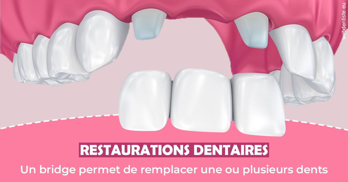 https://dr-picard-nicolas.chirurgiens-dentistes.fr/Bridge remplacer dents 2