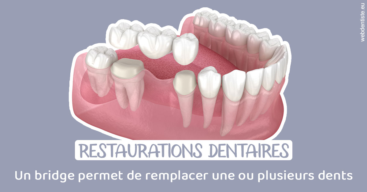 https://dr-picard-nicolas.chirurgiens-dentistes.fr/Bridge remplacer dents 1
