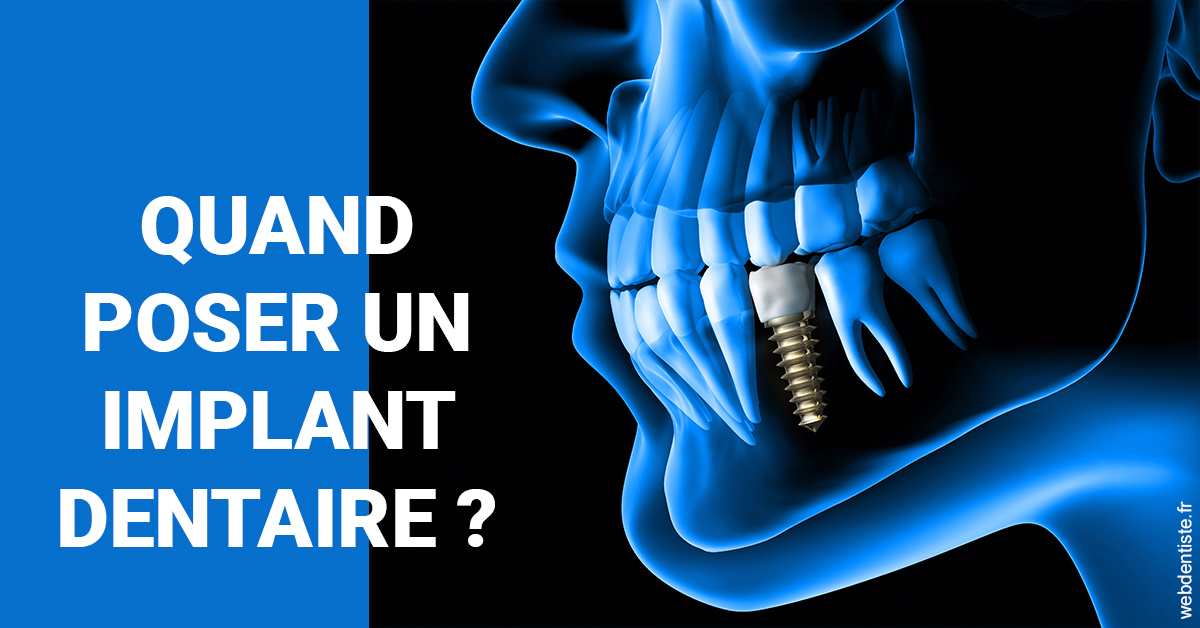 https://dr-picard-nicolas.chirurgiens-dentistes.fr/Les implants 1