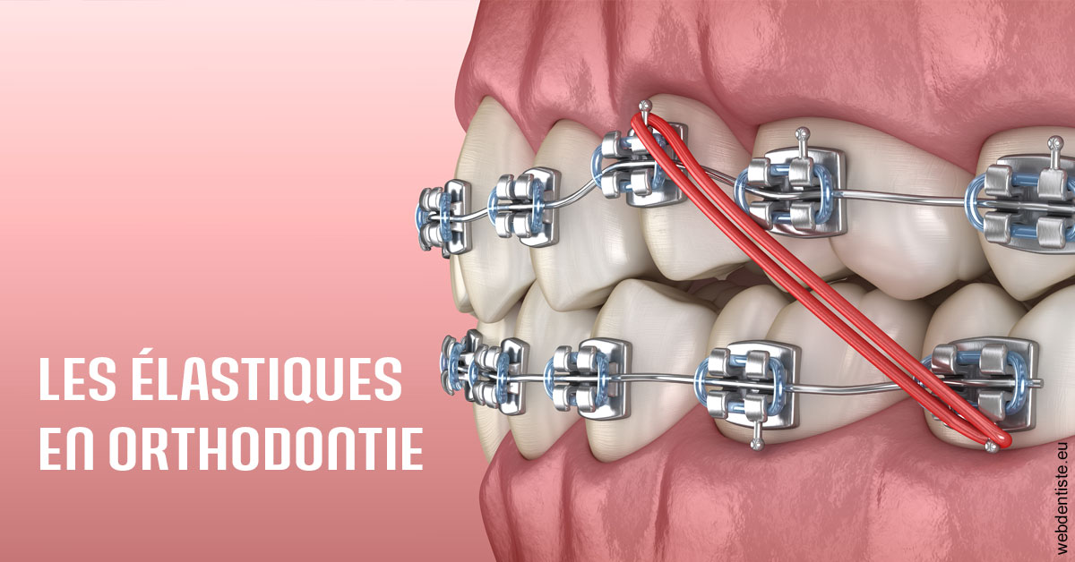 https://dr-picard-nicolas.chirurgiens-dentistes.fr/Elastiques orthodontie 2