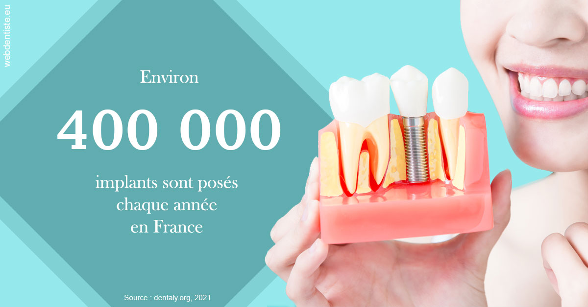 https://dr-picard-nicolas.chirurgiens-dentistes.fr/Pose d'implants en France 2